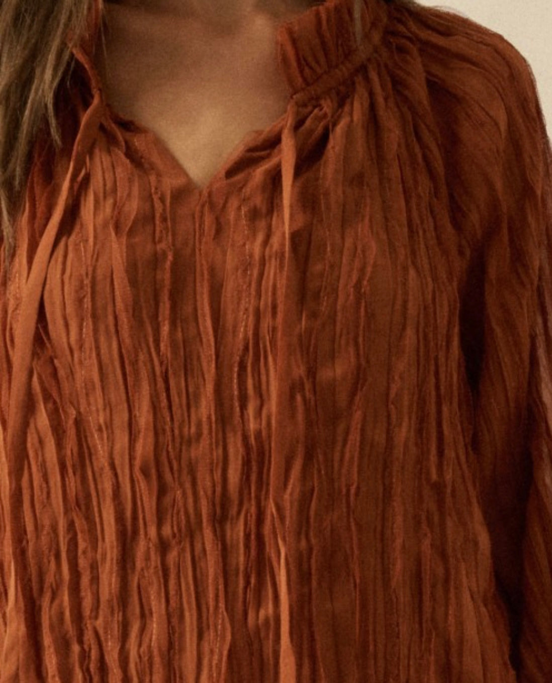 Sunburn Mini Dress